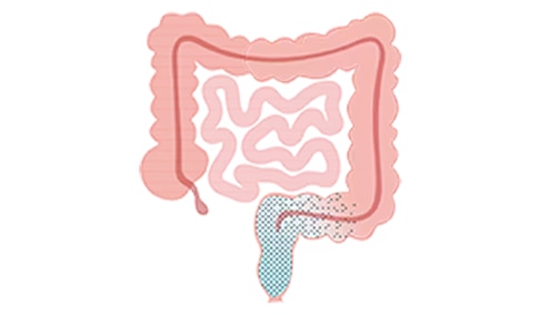 How low-volume TAI works