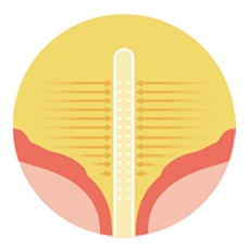 <p>Simpler emptying<sup>5</p>