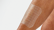 Wound monitoring